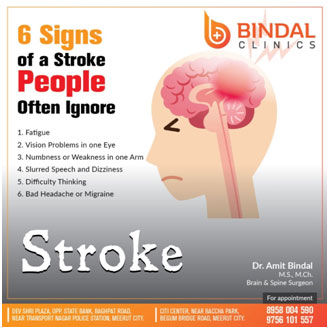 Brain Stroke treatment at Bindal clinics, Meerut Brain Stroke treatment at Bindal clinics, Meerut